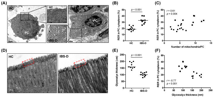 Plasma cell ultrastructure and glycocalyx thickness in the jejunal mucosa of HC subjects and IBS-D patients. (A) Representative transmission electron microscopy images of plasma cells from HC (left panel) and IBS-D (right panel) groups. Inserts show the morphology of the RER in each group. Bar represents 1 µm. (B) Quantification of the percentage of RER area in the cytoplasm (%RER) in plasma cells in HC (n = 11) and IBS-D (n = 9) groups. (C) Correlation assessment between the %RER and the number of mitochondria per plasma cell (pooled participants, n = 20). (D) Representative transmission electron microscopy images of the glycocalyx overlying the microvilli from HC (left panel) and IBS-D (right panel) groups.