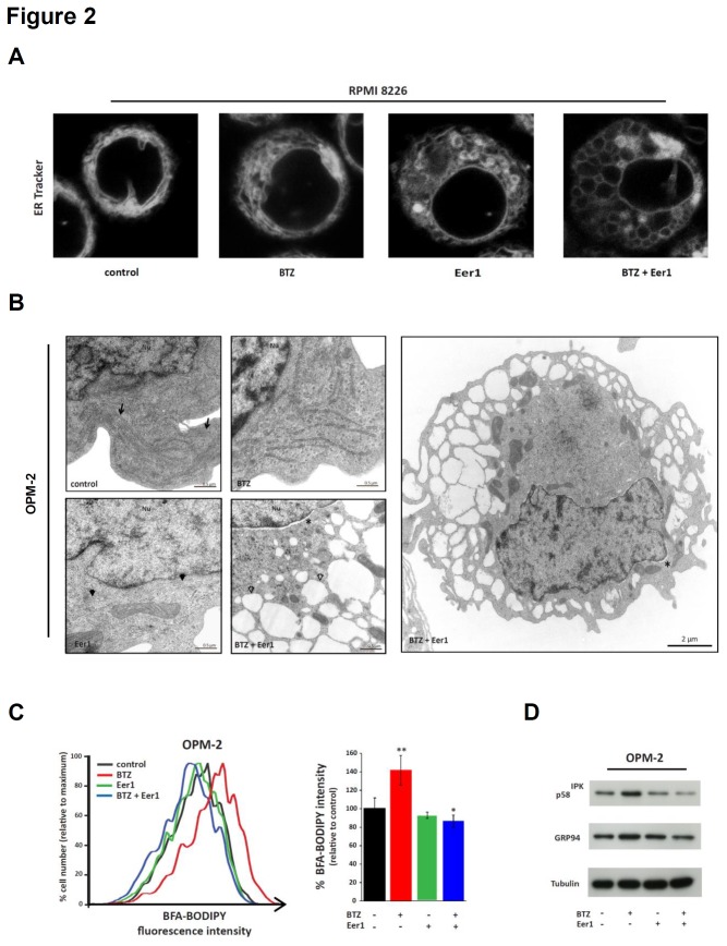 Combined inhibition of p97 and the proteasome dramatically affects ER configuration. ( A ) RPMI 8226 myeloma cells were stained with ER Tracker Blue-White DPX following treatment for 24h with bortezomib (BTZ; 5nM), Eer1 (5µM), or both. Representative confocal microscopic images show minor ER alterations after BTZ treatment, transformation of tubule-lamellar into globular ER structures after treatment with Eer1, and widespread ER vacuolisation after dual treatment. ( B ) Representative electron microscopic images of OPM-2 cells after treatment with BTZ (5nM), Eer1 (5µM), or BTZ and Eer1, for 24h. Arrows indicate classical ER in control cells, black arrowheads indicate moderately dilated and disrupted ER in Eer1-treated cells, and open arrowheads indicate vacuolised ER with reduced ribosomes on the cytosolic ER surface. Another cell treated with Eer1 and BTZ is shown at lower magnification (right panel). Areas of dilated perinuclear space are indicated by asterisks. Nu, nucleus.