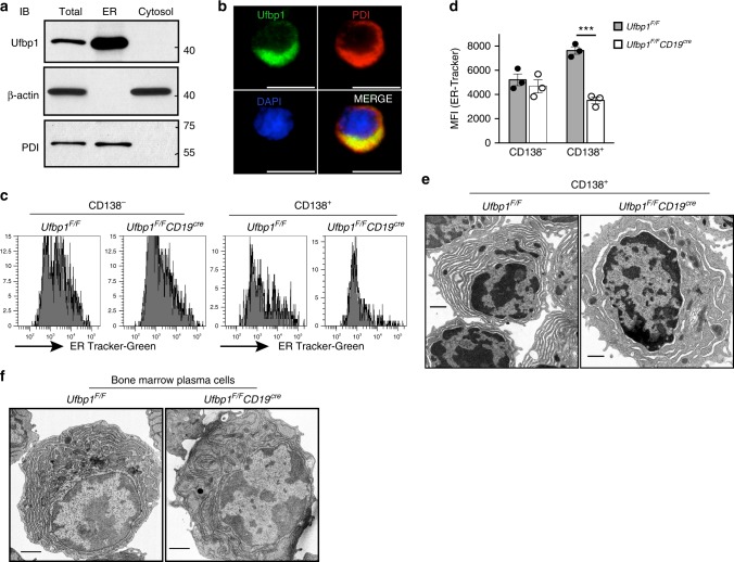 Ufbp1 is required for endoplasmic reticulum (ER) expansion in antibody-secreting cells. e Transmission electron microscope images of CD138 + cells sorted from LPS-stimulated B cell cultures from Ufbp1 F/F and Ufbp1 F/F CD19 cre mice. Scale bars are 1 µm. f Transmission electron microscope images of bone marrow plasma cells isolated from mice of indicated genotype. Scale bars are 1 µm.
